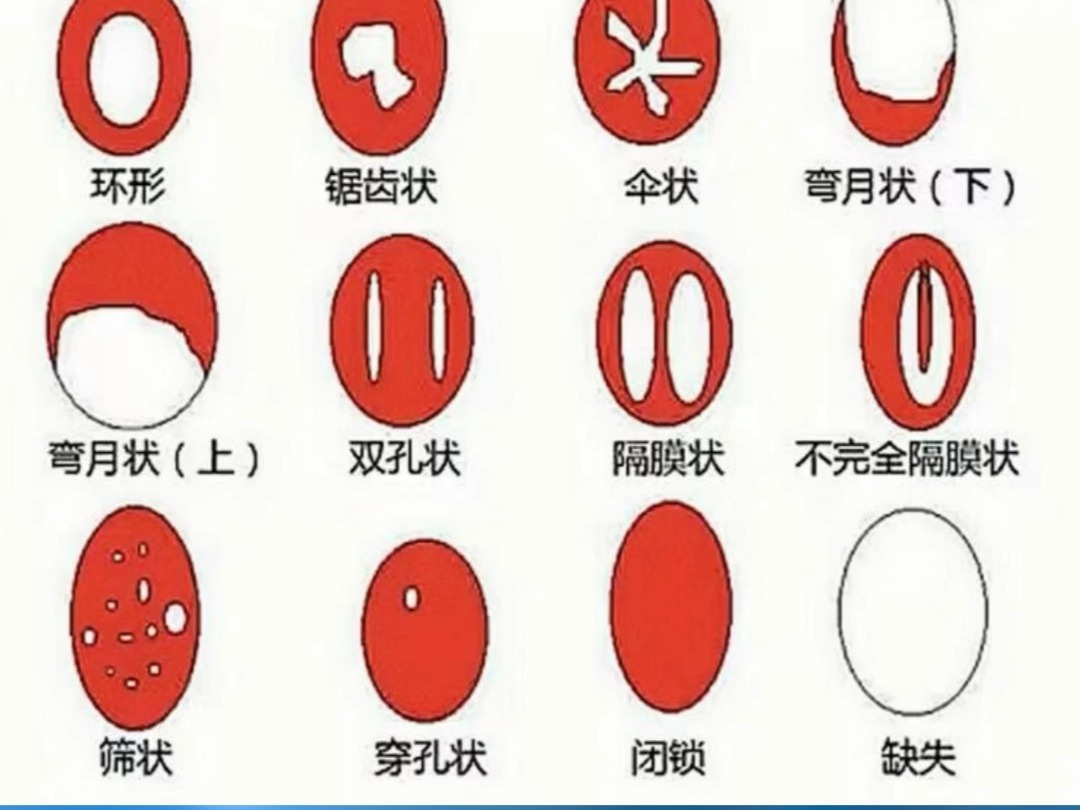 女孩子的第一次不一定都落红哦 因为大部分的人处女膜都是缺失的