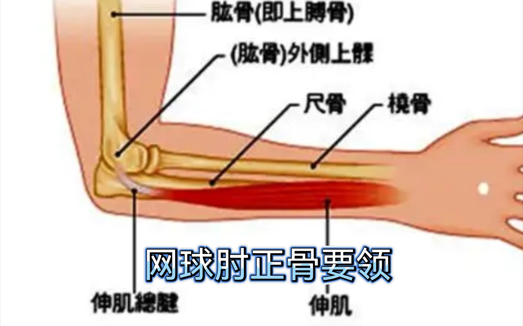 [图]网球肘可以这样轻松解决，认真看很容易就学会了。