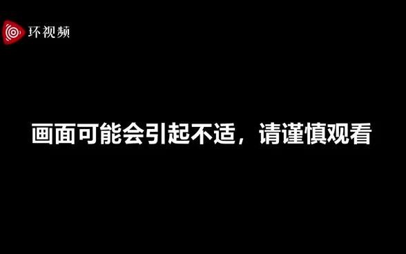 [图]印媒：印度医院13岁女孩遗体无人看管，被流浪狗“啃食”