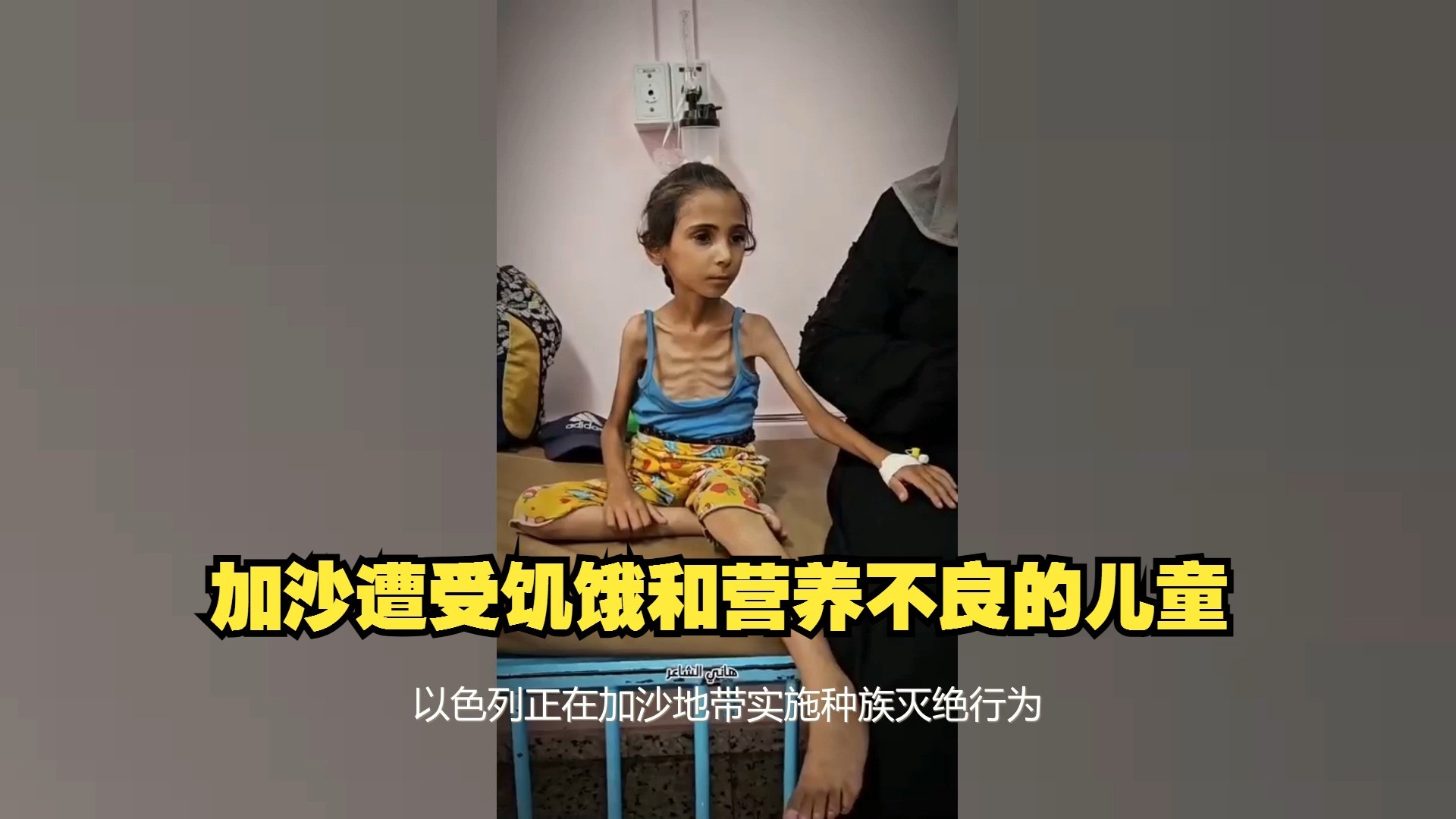 一名加沙地带因以色列的封锁而遭受饥饿和营养不良的儿童