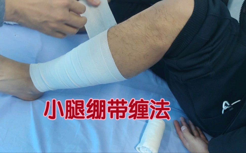 小腿繃帶纏法適用於因運動強度過大導致的骨膜炎疲勞性骨折小腿肌肉肌