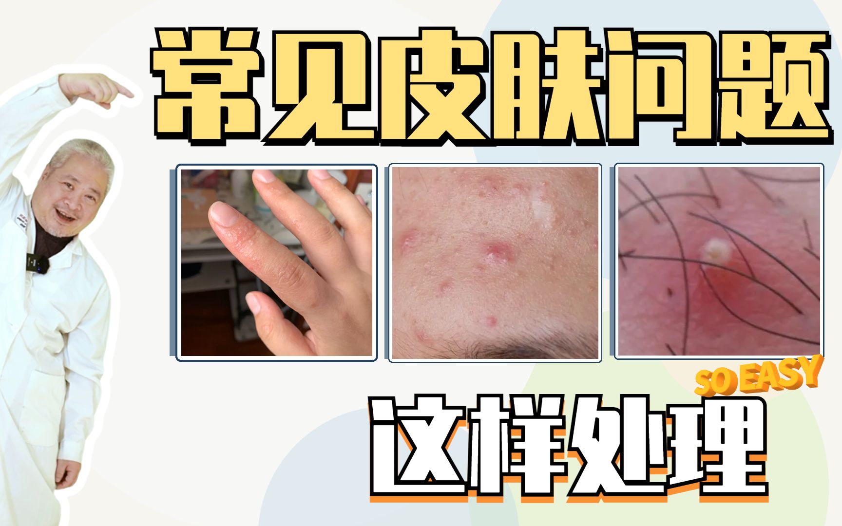 [图]【皮肤科孙叔】夏季常见皮肤病怎么处理-省流版，10秒不多不少刚刚好