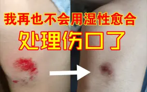 Video herunterladen: 大失败！普通人使用湿性愈合的糟糕后果