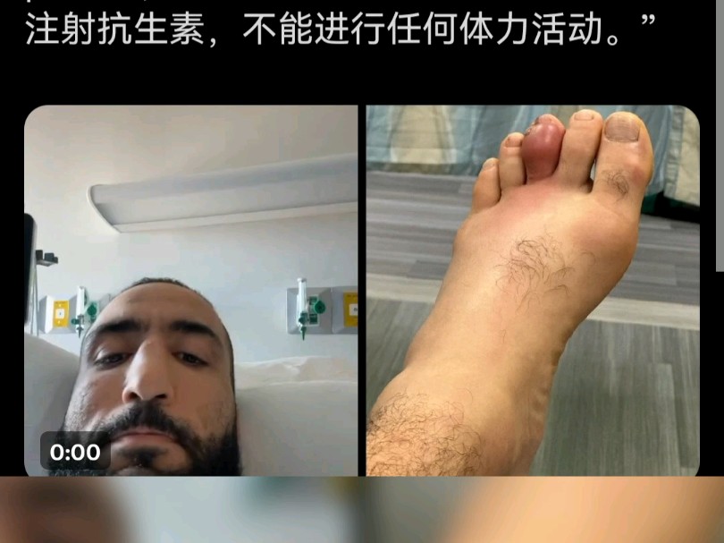 大眼正式退出UFC310,他脚骨感染住院了,祝他早日康复!呆拿:呼叫佩雷拉呼叫佩雷拉,佩雷拉,收到请请回复.哈哈哈哈哔哩哔哩bilibili