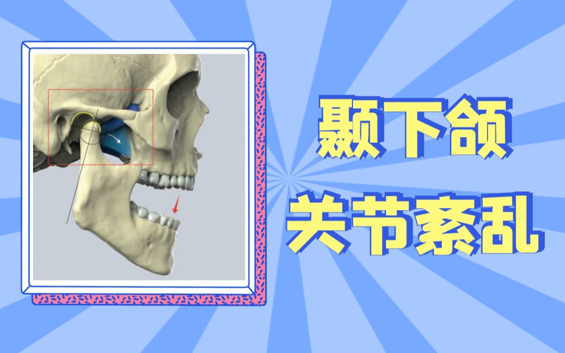 稳定颞下颌关节运动【改善张嘴弹响】