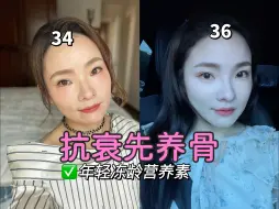 Télécharger la video: 养骨不显老！年龄成迷的女生都在保养骨质！