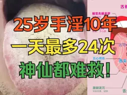 Download Video: 25岁小伙子，手淫10年，一天最多24次，神仙都摇头了！！