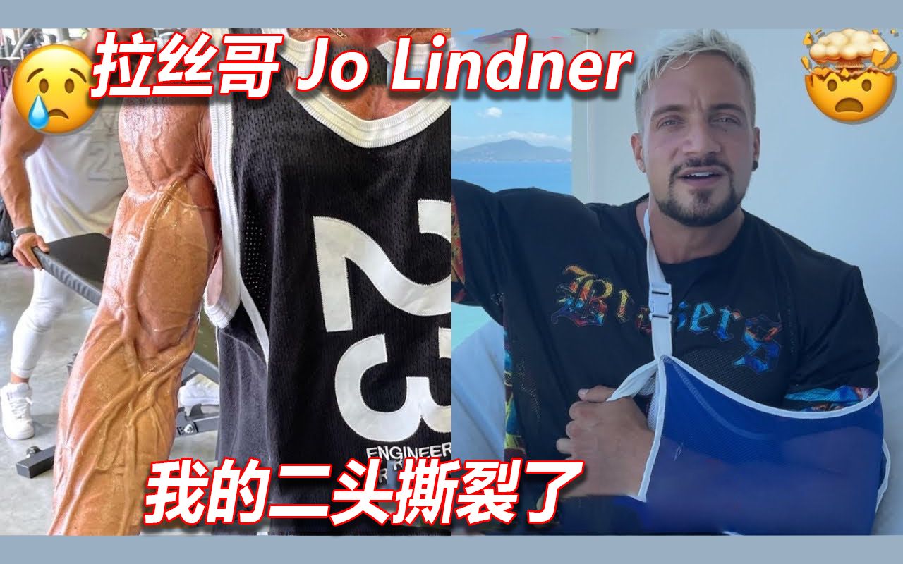 "我的二头撕裂了!"拉丝哥二头撕裂申明【jo lindner/中字】