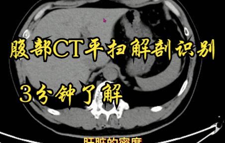 腹部CT平扫大致解剖识别,腹部CT平扫重点看哪些结构?3分钟初步了解哔哩哔哩bilibili