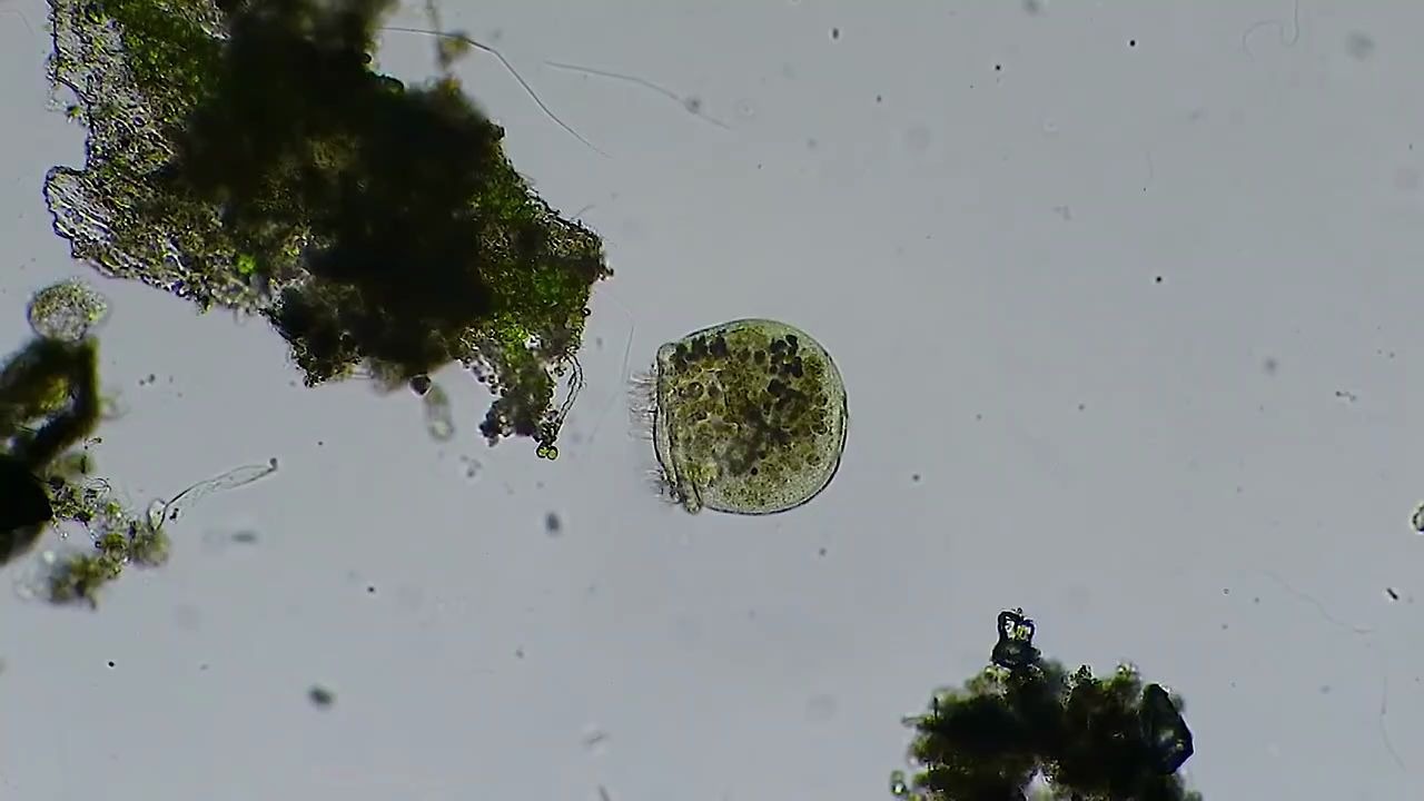 显微镜下观察阔口游仆虫,一种原生动物,能清晰看到所有细胞器