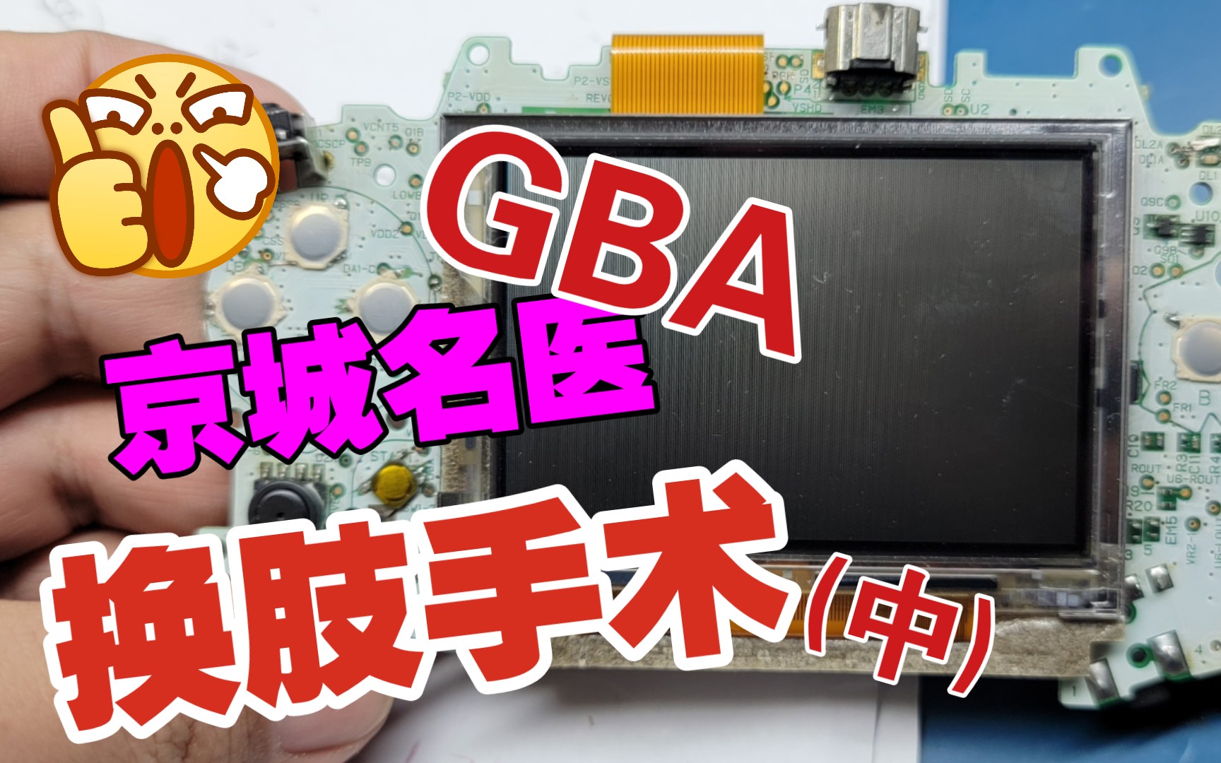 [图]京城名医 肢体替换术 gba维修按键全程操作(中)