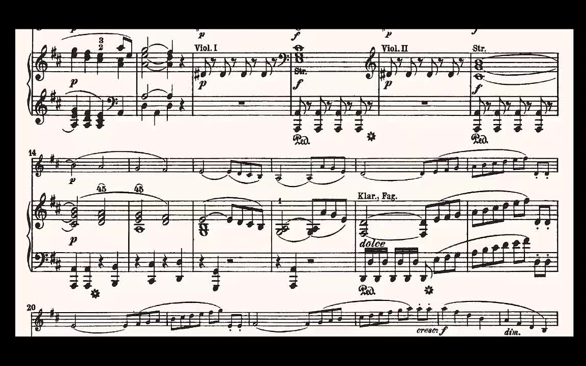 [图]【钢琴伴奏】Beethoven Violin Concerto Op.61 Accompaniment 贝多芬D大调小提琴协奏曲（op.61) 钢琴伴奏