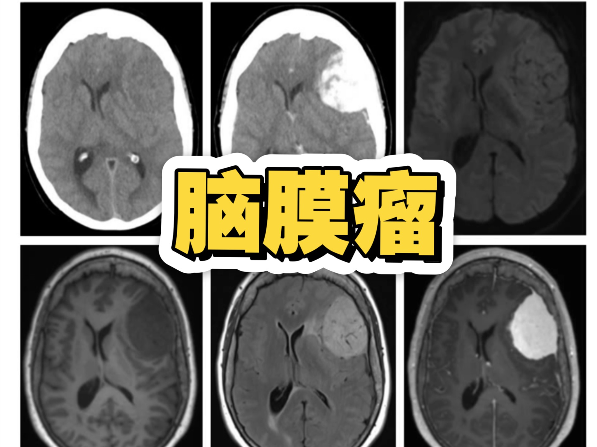 神经外科领域的新技术与挑战
