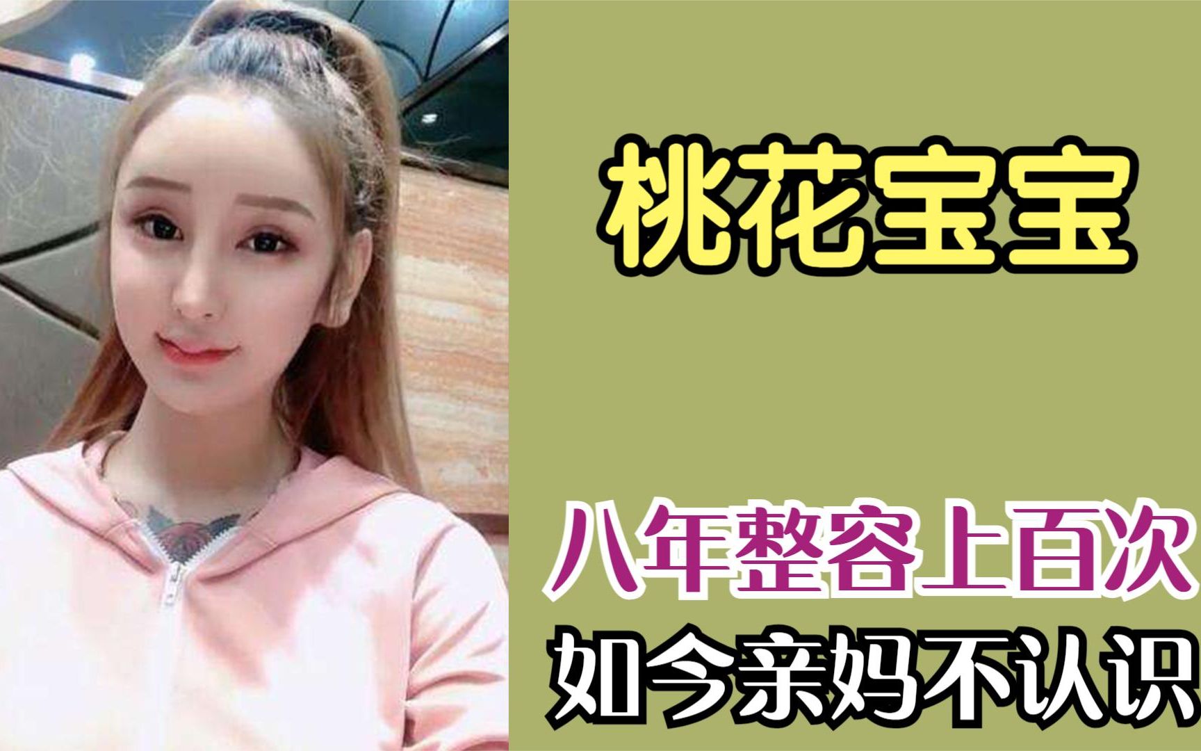 桃花宝宝"整容上瘾",八年整容上百次,如今亲妈都不认识!