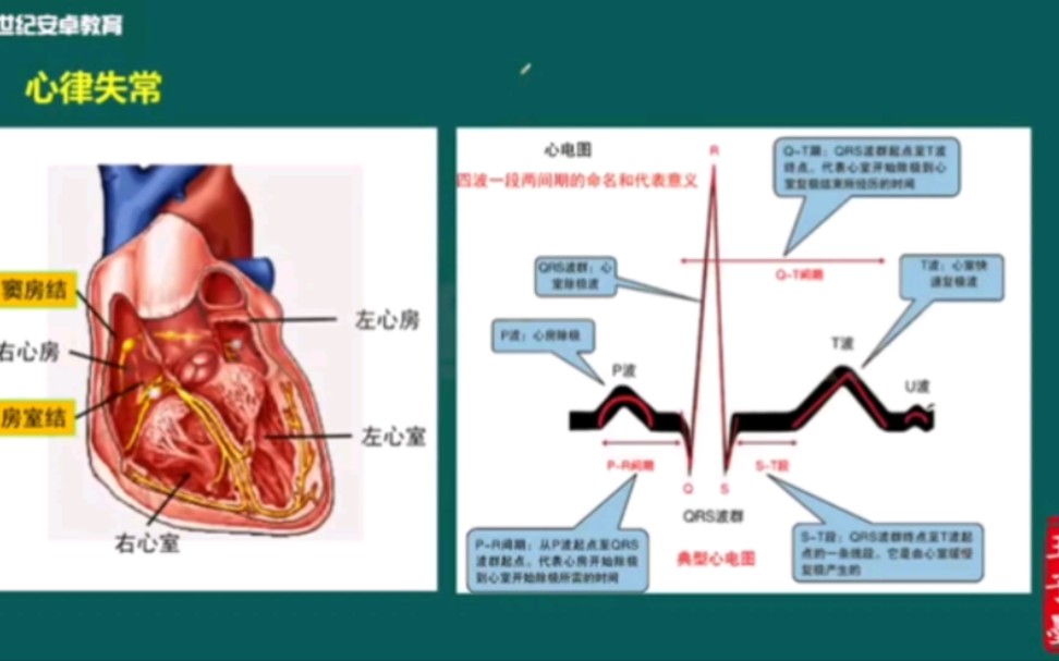 [图]8、内科学-心率失常