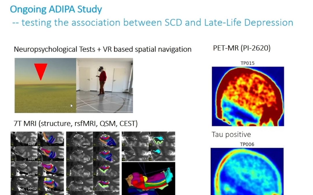 230509University of Bonn Michael WagnerRelevance of minor neuropsychological..哔哩哔哩bilibili