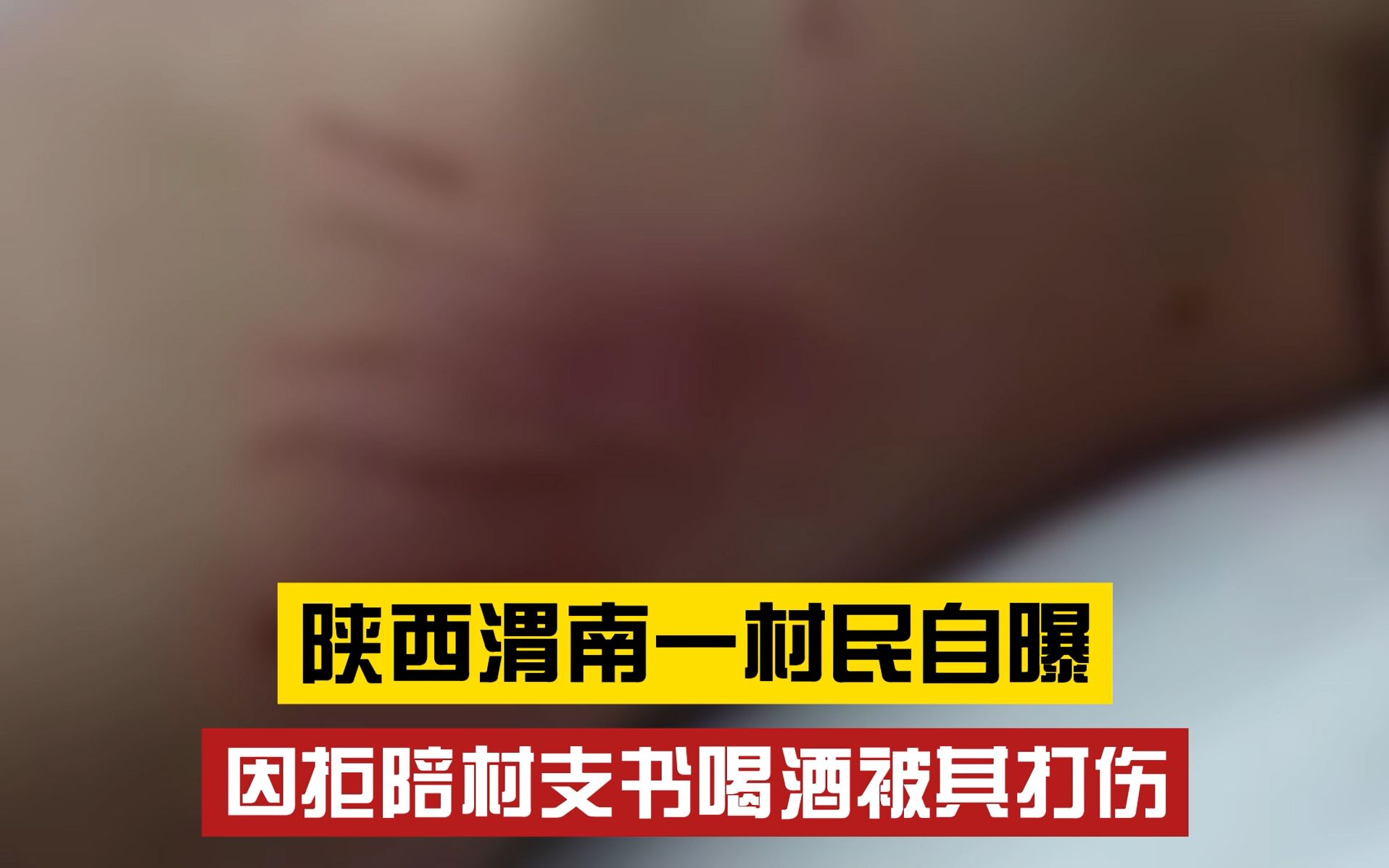 群情激愤!陕西渭南一村民自曝 因拒陪村支书喝酒被其打伤 官方:若查实将依法处理哔哩哔哩bilibili