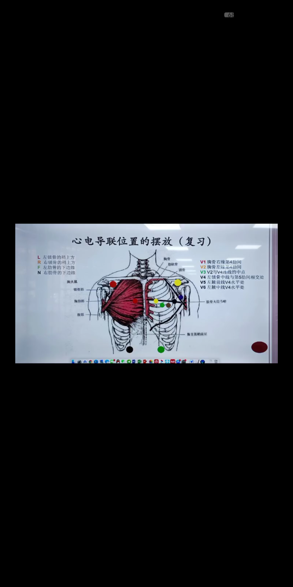 心电导联位置的摆放图示哔哩哔哩bilibili