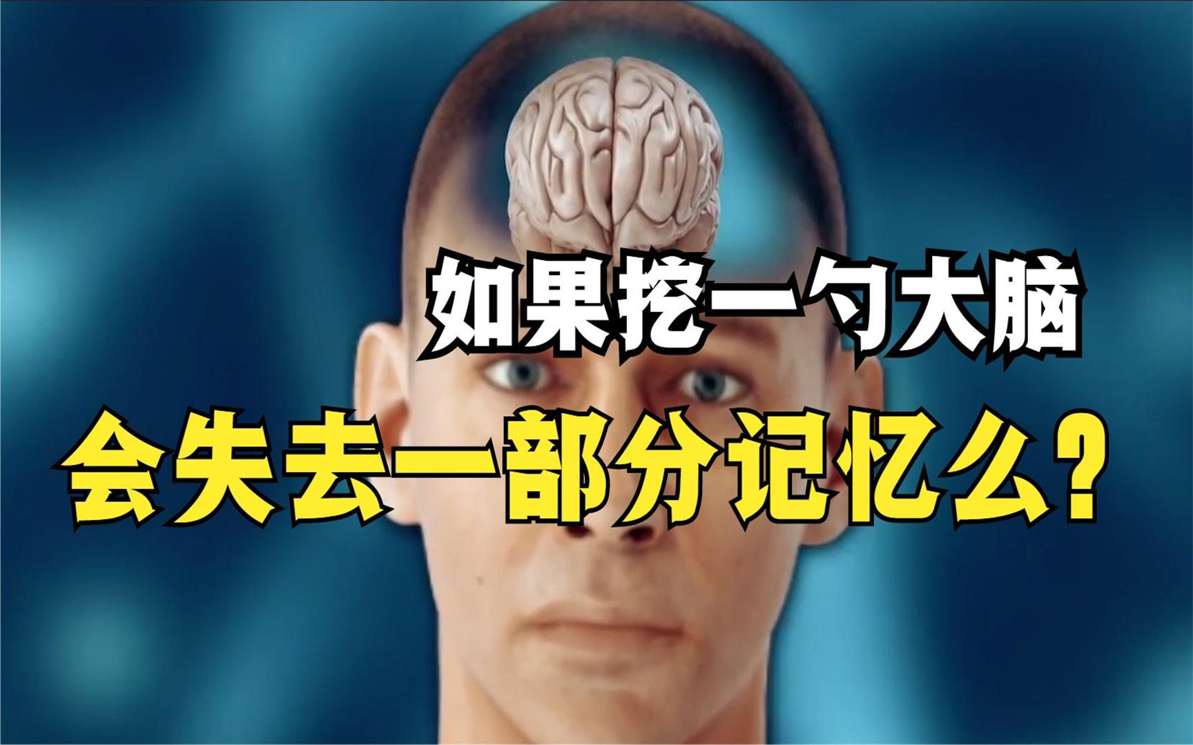 活动  如果挖一勺大脑,会失去一部分记忆么?
