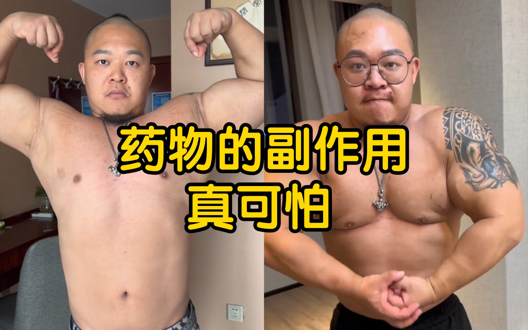 [图]常熟阿诺用药十几年，终于把自己练成一坨勾史，肉像发臭的烂泥