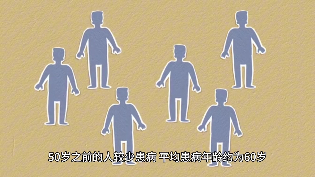 帕金森病患者的情况