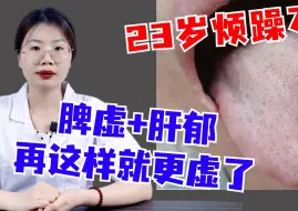 Download Video: 潘大夫舌诊：23岁烦躁不安，脾虚+肝郁，再这样下去就更虚了