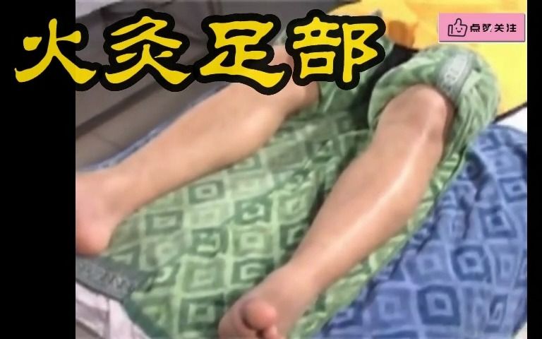 火灸足部1哔哩哔哩bilibili