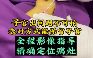 Tải video: 肌瘤/腺肌症不开刀，一针见效保子宫