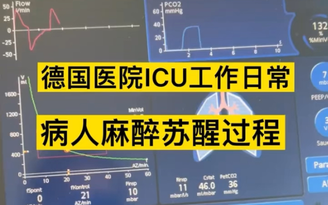 ICU工作日常# 护士懂护士 # 德国双元制 # 护士出国 # icu # 德国护士annby哔哩哔哩bilibili