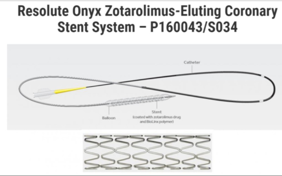 【转载】医疗器械美敦力Resolute Onyx药物洗脱支架冠脉哔哩哔哩bilibili