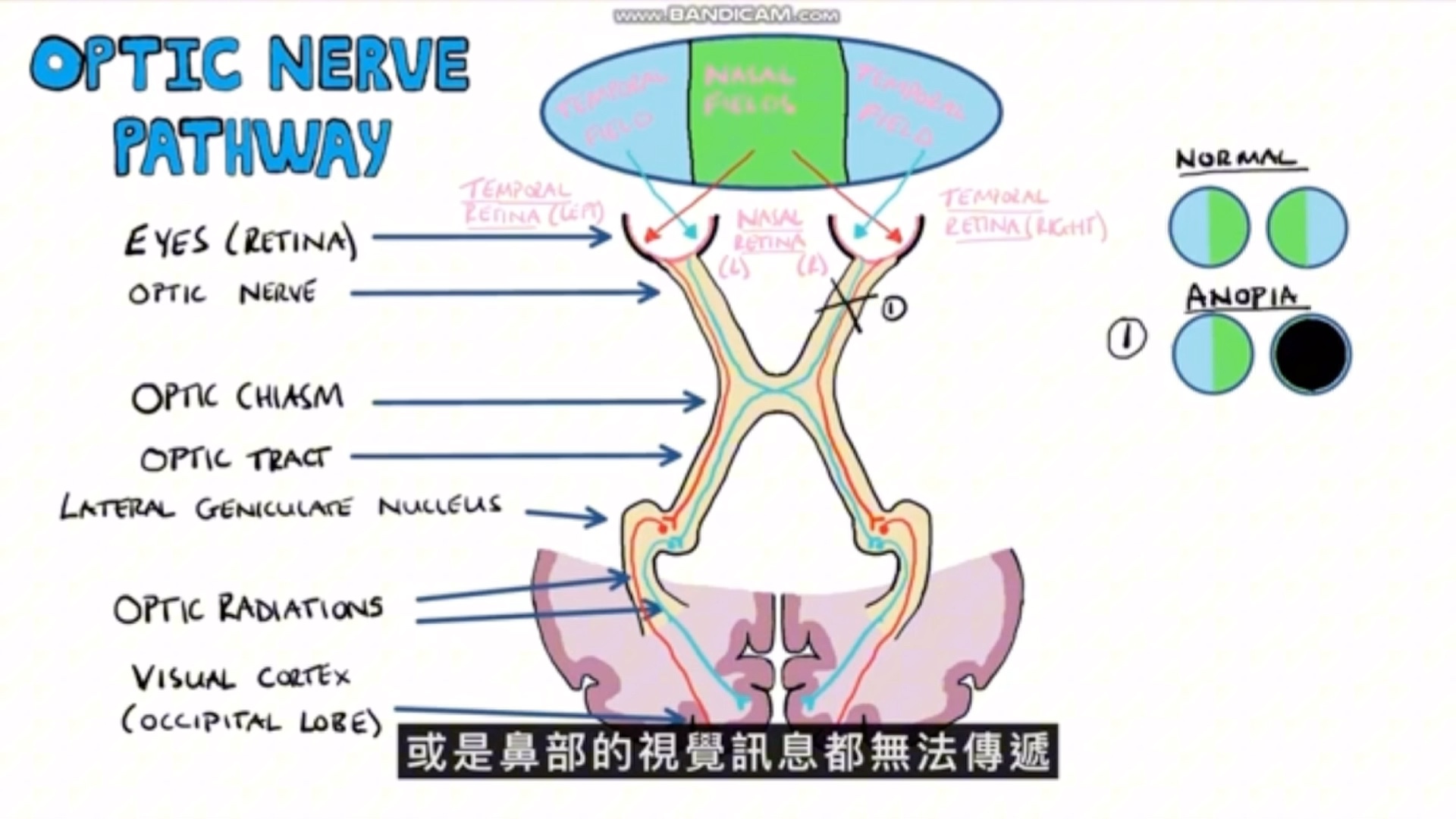 同侧偏盲|双颞侧偏盲|视野缺损