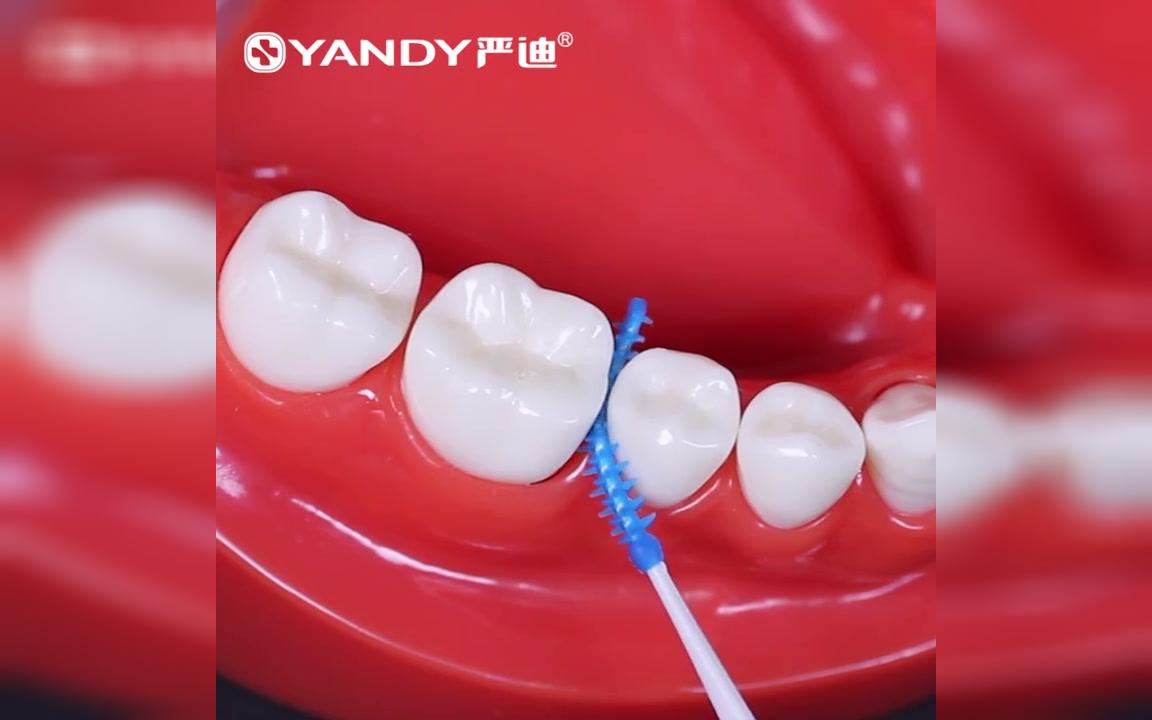 牙龈易出血塞牙怎么清洁?严迪硅胶牙缝刷