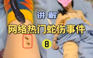 Download Video: 女子入住庄园酒店被银环蛇咬伤？差点丢掉性命！视力下降到了0.3！