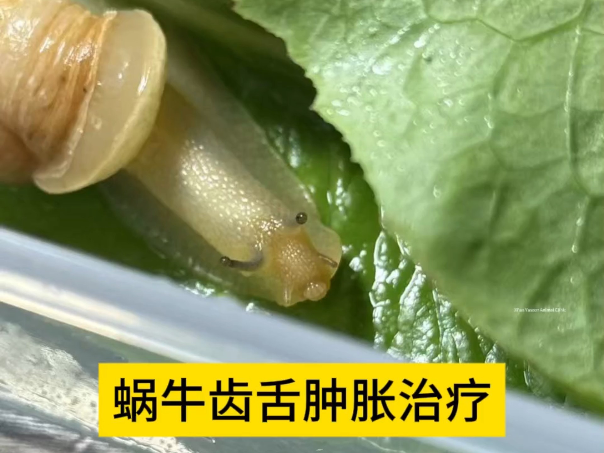 蜗牛齿舌肿胀治疗