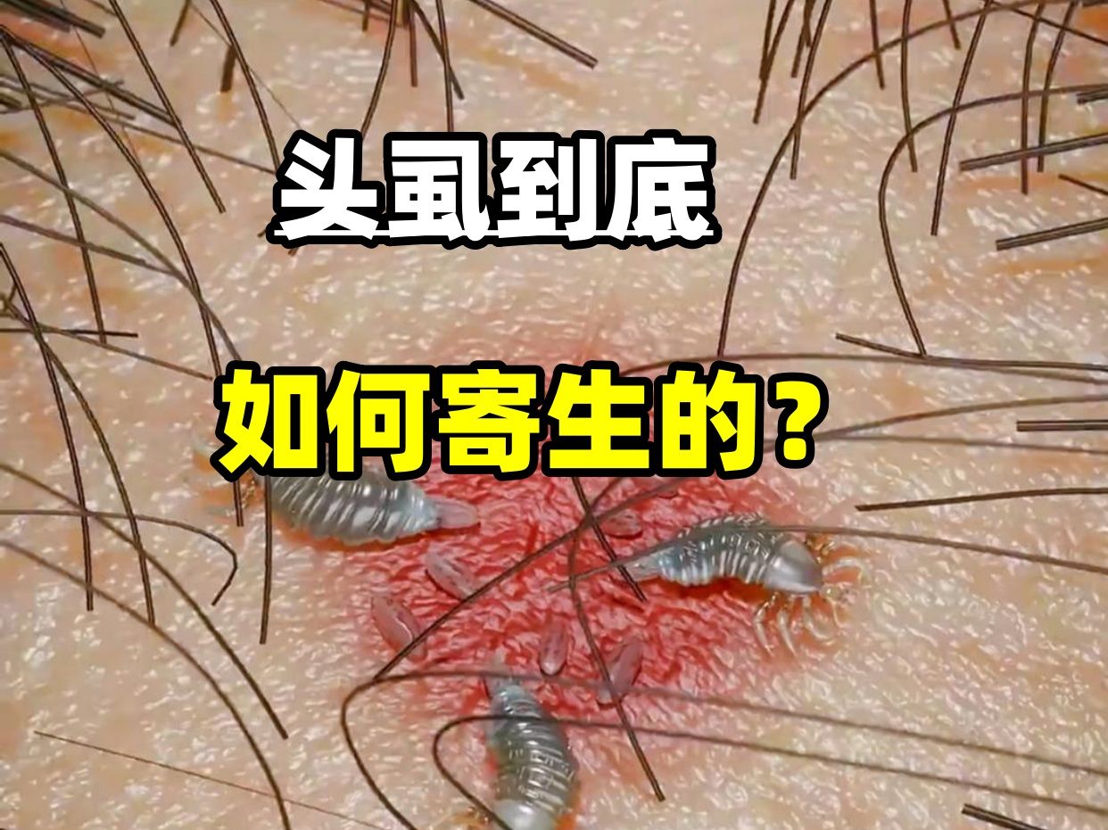 头虱到底如何寄生的
