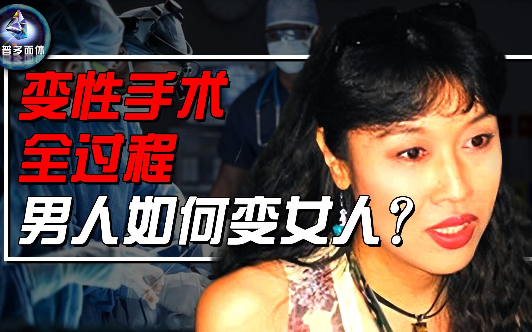 揭秘变性手术全过程,男生想做个女孩子有多难?需要几个步骤?