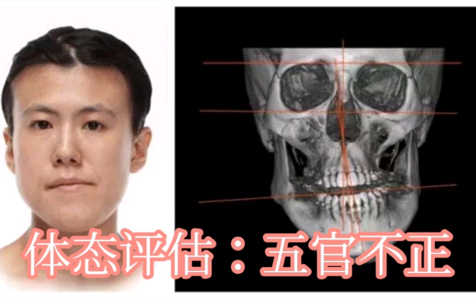 体态评估五官不正生活中需警惕出现以下情况