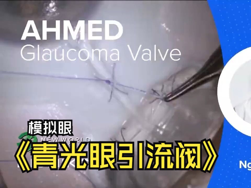 【中英双字】【模拟眼青光眼引流阀】BIONIKO EX1 with AHMED GLAUCOMA VALVE (AGV)  by BAC NGUYEN, M哔哩哔哩bilibili