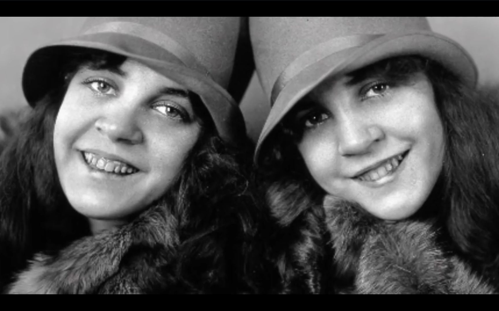 20世纪知名的连体双胞胎,是美国恐怖故事畸形秀角色原型