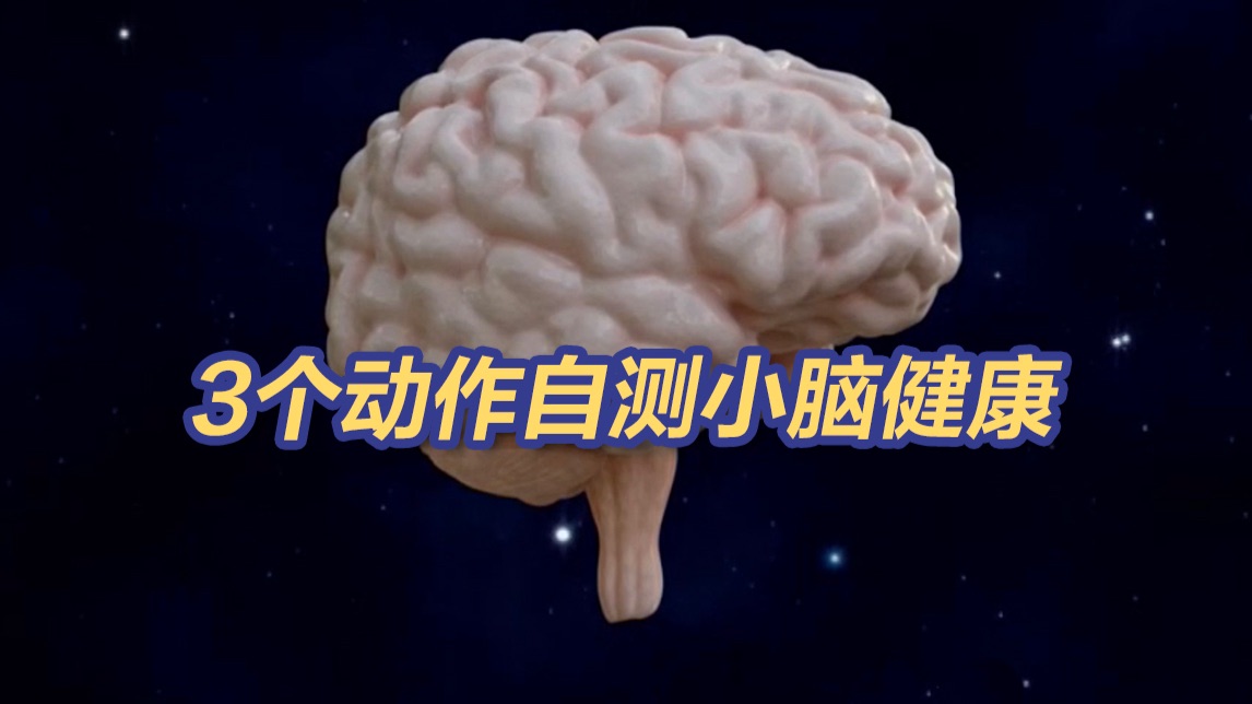 警惕！做不到这3个动作，可能是小脑出问题了