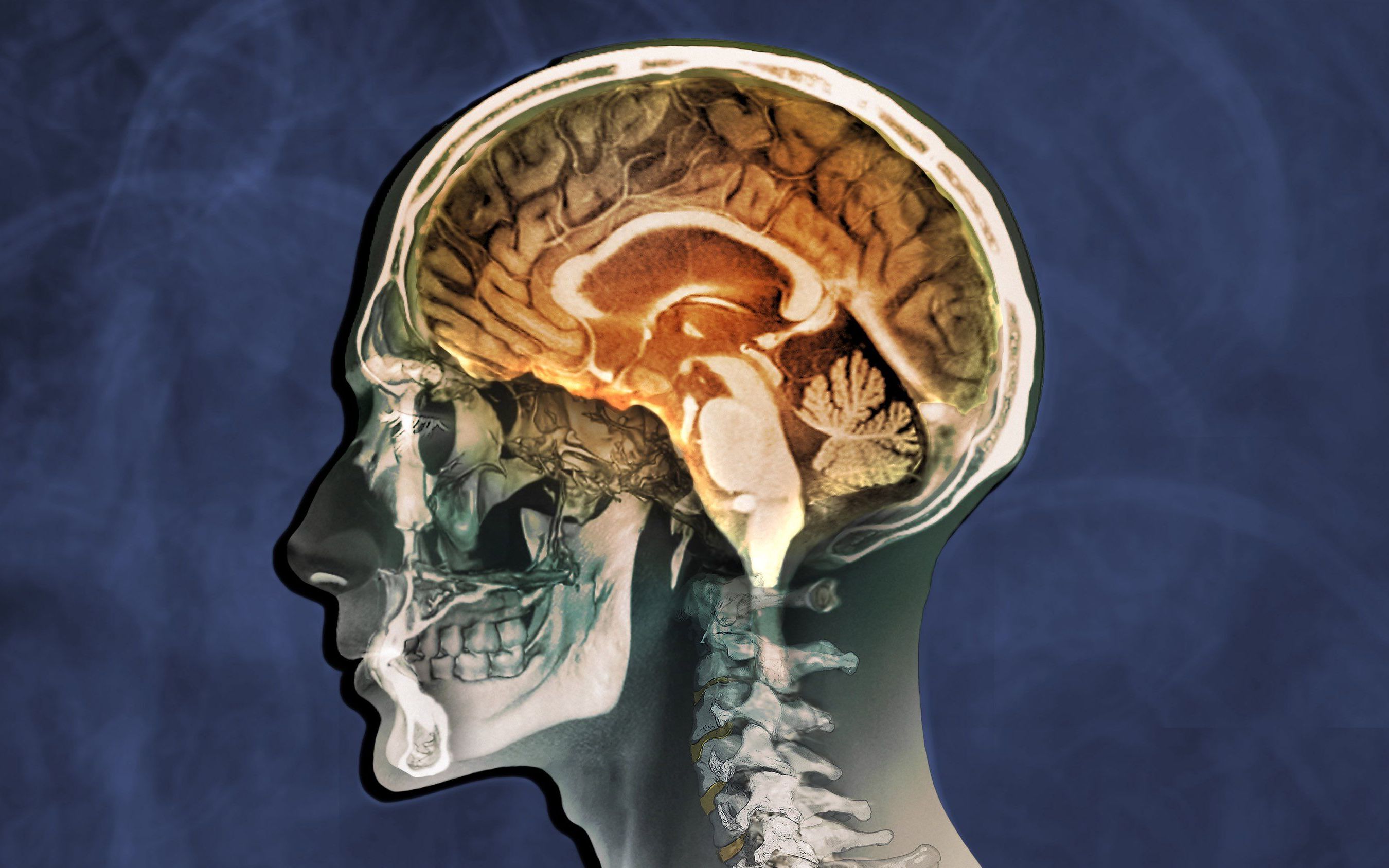 一位女性在午餐时喝下了35浓度的过氧化氢溶液这是她的大脑发生的变化