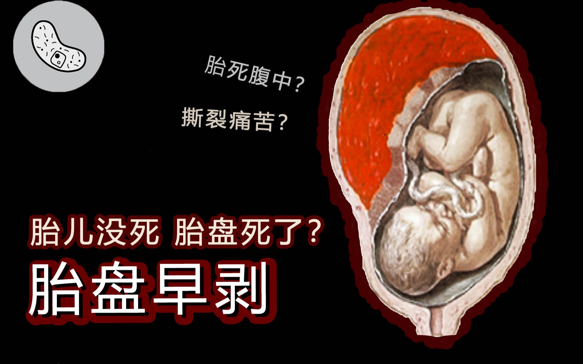 胎死腹中的症状是什么(胎儿停止成长的征兆)