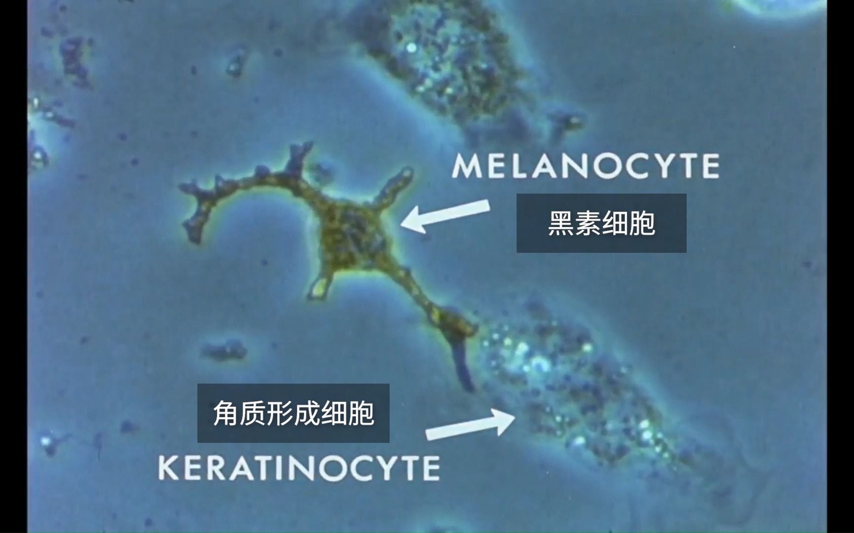 [图]【中英字幕】黑色素的传递，光学显微镜下黑素细胞和角质形成细胞的交互作用