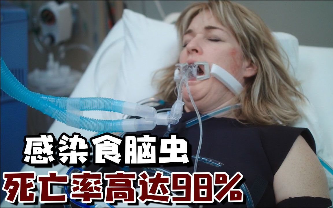 女人感染食脑虫,差点变成行尸走肉,千万别乱喝生水