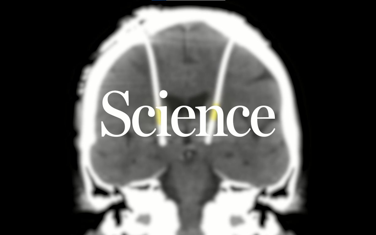 尖端医疗|更适合植入活体组织的“凝胶软电极”【Science科普视频】哔哩哔哩bilibili