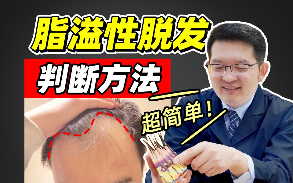 脂溢性脱发初期3大症状!超准!【进来自测】哔哩哔哩bilibili