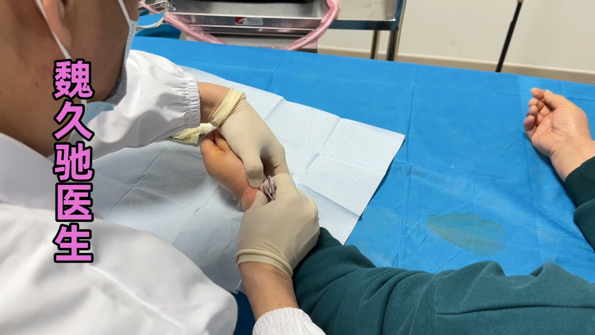 微创手术怎样治疗手腕腱鞘炎?