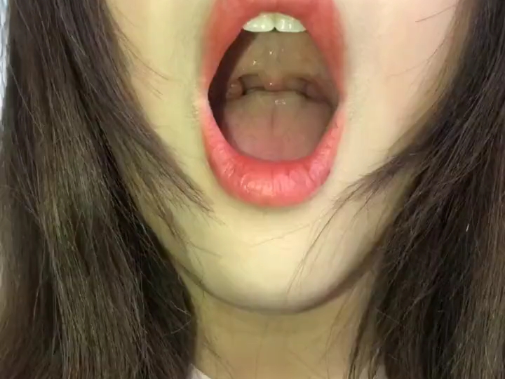 女大口腔检查1