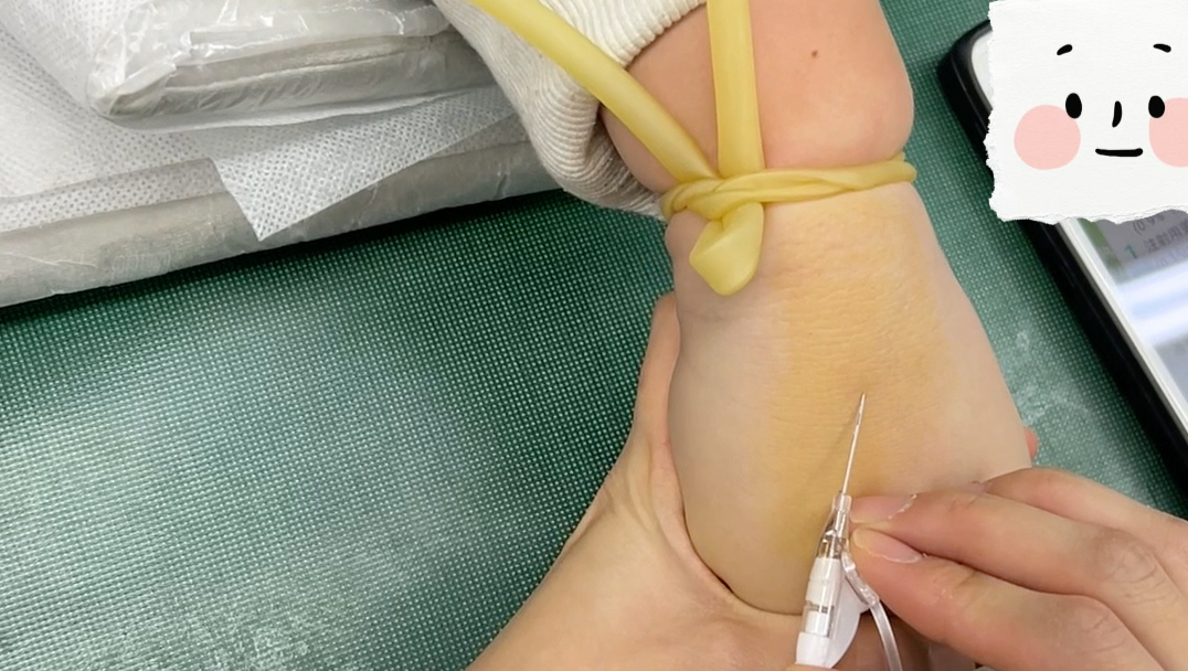 小儿静脉留置针日常分享