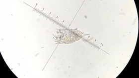 用镭射笔做显微镜 看见水中微生物 哔哩哔哩 つロ干杯 Bilibili